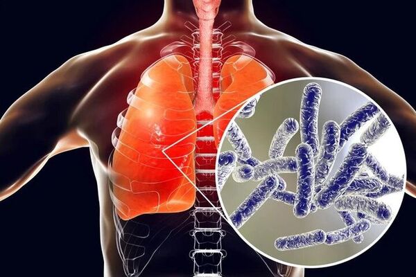 Recomiendan mantenimiento en hospitales para evitar contagios de “Legionella” | 1000 Noticias
