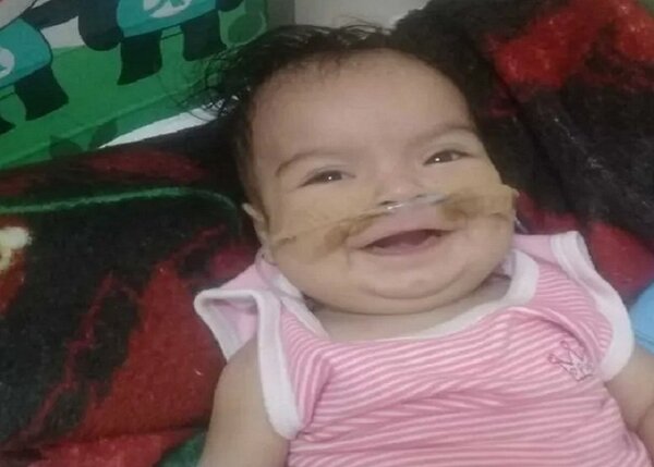 La pequeña Jade será sometida a una compleja cirugía y necesita de todos | Noticias Paraguay