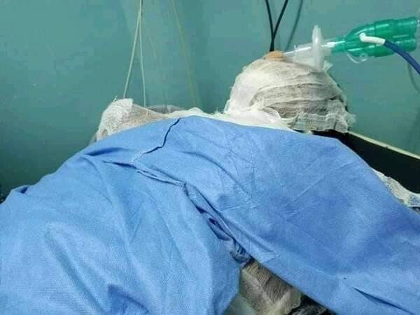 Crónica / ¡De terror! Roció con alcohol a su pareja y la quemó viva