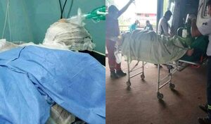 Hombre roció con alcohol a su concubina y la quemó viva por celos - Noticiero Paraguay