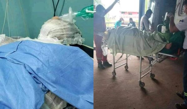 Hombre roció con alcohol a su concubina y la quemó viva por celos - Noticiero Paraguay