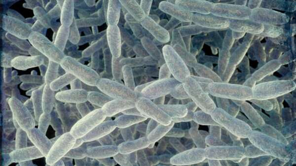 Diario HOY | Argentina detecta 22 casos por Legionella y dice que pueden aparecer más