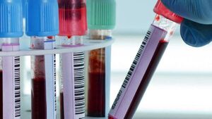 Podrían detectar cáncer antes de que aparezcan síntomas