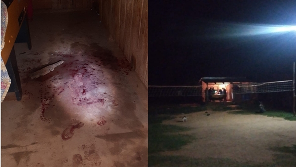 Partida de billar termina con un herido en Alto Verá