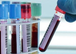 Un análisis de sangre podría detectar cáncer antes de que aparezcan síntomas