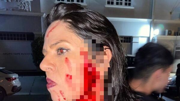 En un bar chuchi, ligó botellazo en la cara