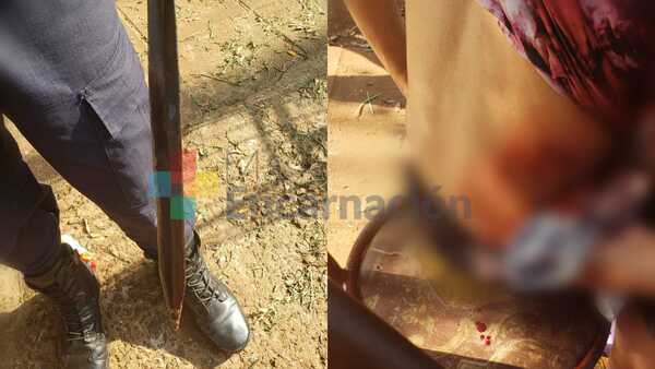 Hieren gravemente a un adolescente que tomaba tereré en una plaza del barrio San Pedro de Encarnación