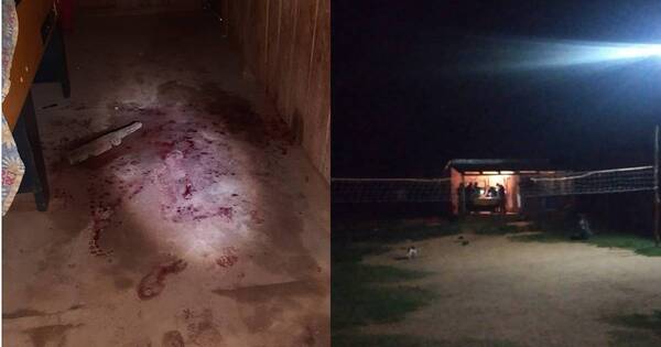 La Nación / En Itapúa un hombre perdió el brazo tras ronda de tragos y pelea