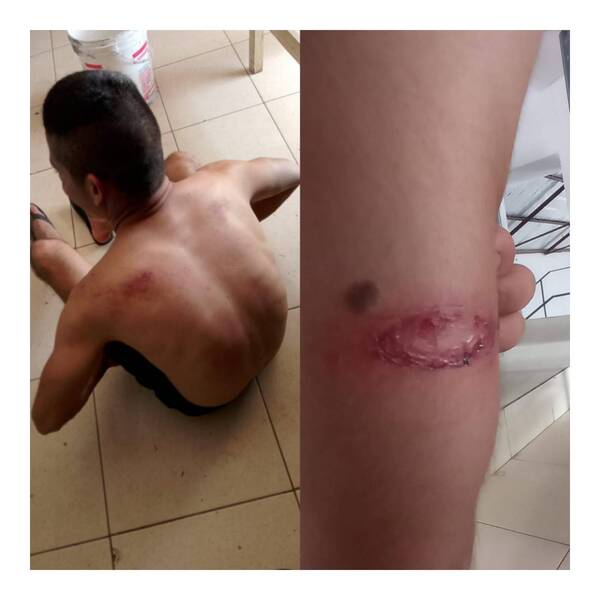 Crónica / Cadete denunció a teniente por agresión: “Me pegó 14 veces con palos de escobas”