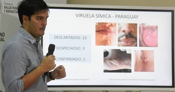 La Nación / Viruela símica: único caso confirmado ya obtuvo el alta médica