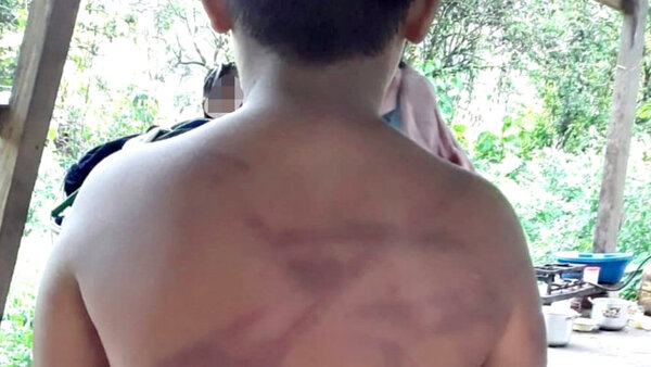 Diario HOY | Vudeo: "Rompió 7 palos de escobas por mí", denuncian tortura en la Armada