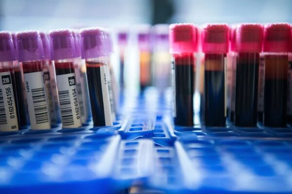 Diario HOY | Un análisis de sangre podría detectar hasta 50 tipos de cáncer antes de los síntomas