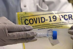 Diario HOY | La OMS da por casi terminada la pandemia de covid-19