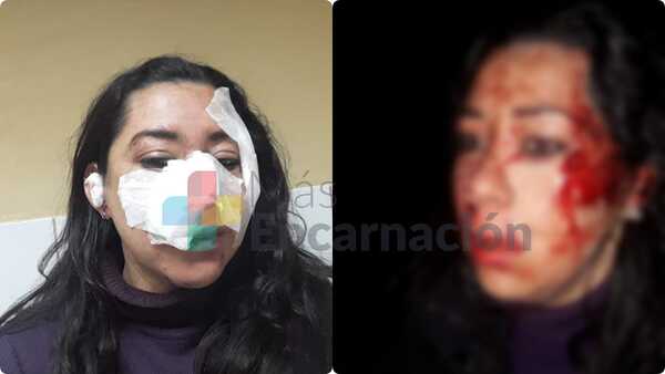 Intento de feminicidio en Cambyretá: Hombre intentó aplicar estocadas a su ex pareja