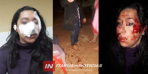 UN HOMBRE INTENTÓ MATAR A PUÑALADAS A SU EXPAREJA EN CAMBYRETÁ