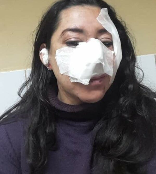¡La desfiguró! Su expareja le salió de un yuyal y trató de matarla a estocadas en Cambyretá