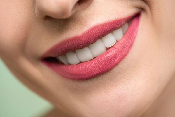Sarro dental: ¿cómo prevenir su aparición?