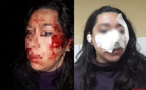Mujer fue brutalmente atacada con cuchillo por su expareja - Noticiero Paraguay