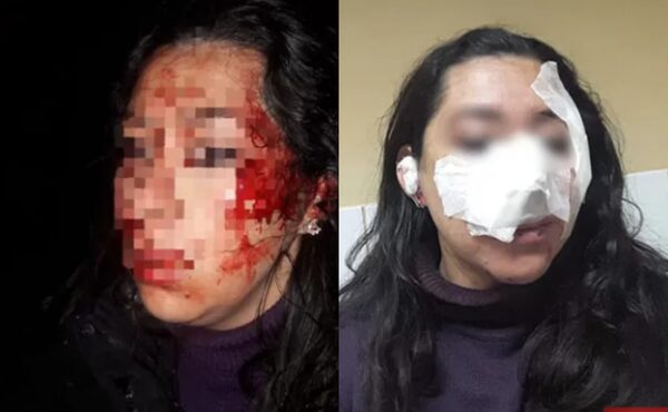 Mujer fue brutalmente atacada con cuchillo por su expareja - Noticiero Paraguay