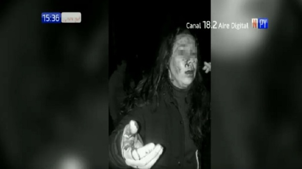 Detienen a hombre tras supuesto ataque bestial a su expareja | Noticias Paraguay