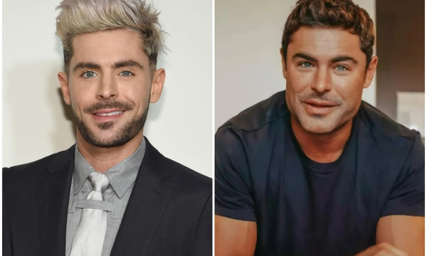 Zac Efron casi muere en accidente que deformó su cara