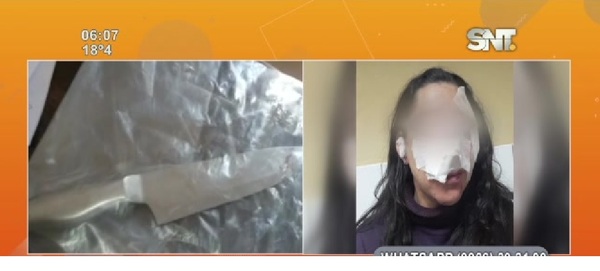 Epidemia criminal: Intento de feminicidio - SNT