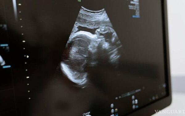 Mujeres de Hungría serán obligadas a escuchar los latidos del feto antes de un aborto – Prensa 5