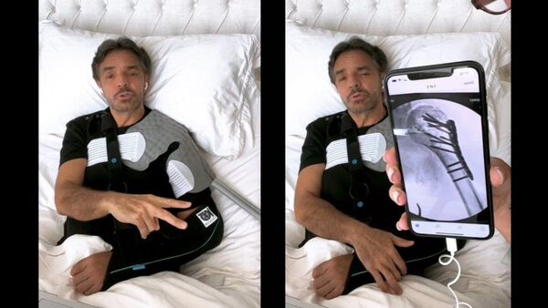 Eugenio Derbez habló de su accidente: "Me desmayé del dolor"