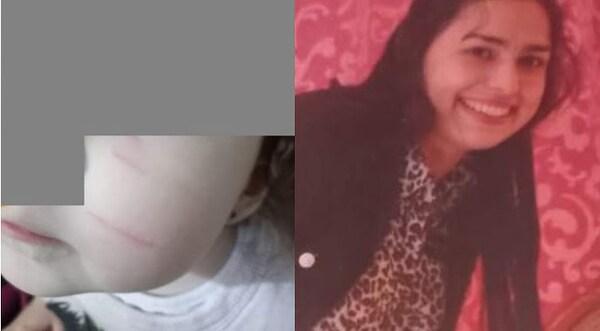 Imputarían por lesión a niñera que maltrató a niña de 2 años - Noticiero Paraguay