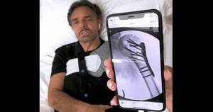 La Nación / Eugenio Derbez reapareció en Instagram tras su accidente