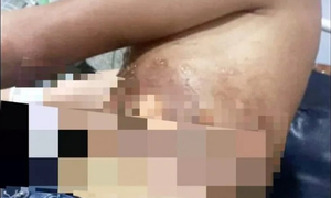 Un rayo cayó sobre un celular enchufado y ocasionó graves quemaduras a un joven - OviedoPress