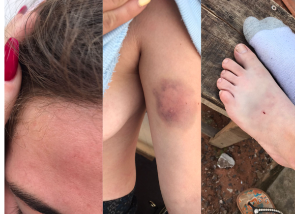 ¡De terror! ¡Reina de belleza paraguaya fue violada y clama justicia!