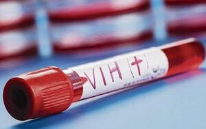 Al menos tres jóvenes por día se infectan con el VIH en Paraguay – Prensa 5