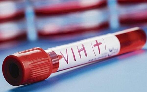 Al menos tres jóvenes por día se infectan con el VIH en Paraguay – Prensa 5