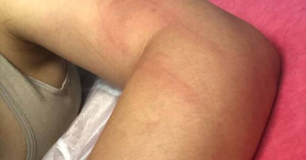 La Nación / Fue víctima violencia e de intento de feminicidio y, pese múltiples denuncias, presunto agresor sigue libre