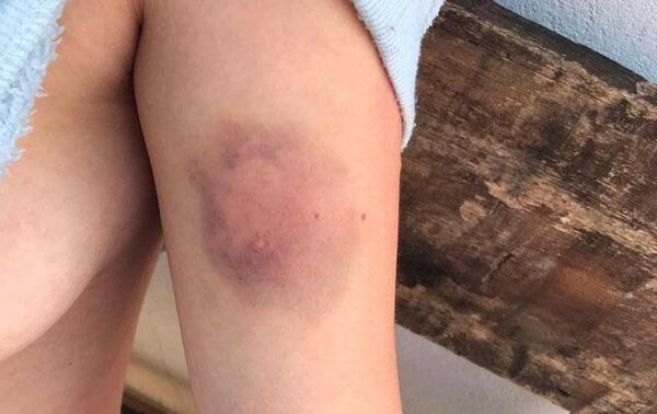 Joven víctima de abuso descubre que acusado fue liberado por orden del fiscal en San Lorenzo – Prensa 5