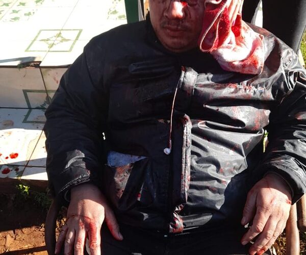 Motociclista se “tragó” curva y termina herido – Diario TNPRESS