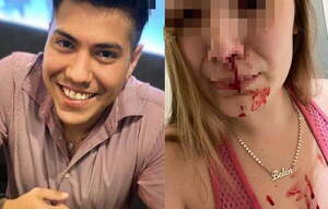 Mujer denunció a su expareja por golpearla a ella y a su bebé de 10 meses - Noticiero Paraguay