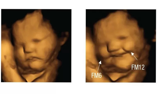 El estudio que mostró que los bebés en el vientre ‘sonríen’ cuando sus mamás comen zanahorias - OviedoPress