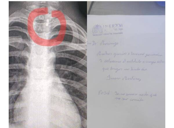 Crónica / La emotiva carta de agradecimiento de un niño para los doctores que le salvaron la vida