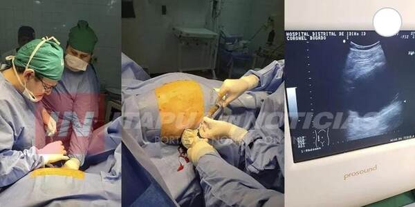FELIZ DÍA A LOS CIRUJANOS, EN EL HOSPITAL YA VAN POR LAS 3.500 CIRUGÍAS