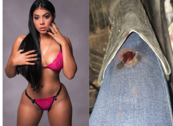 Modelo Amazonas recibió patada de su caballo en su debut y quedó chalai