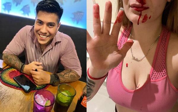 Hombre se molestó porque su hijo no paraba de llorar, golpeó a la mamá y a su bebé de 11 meses – Prensa 5