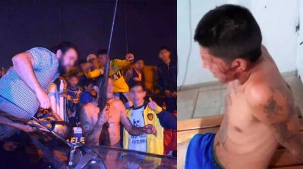 Crónica / Festejos por el chanchón: Joven herido de bala en pelea de barras bravas identificó a su agresor