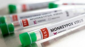Salud anuncia segundo caso positivo de viruela del mono