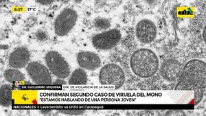 Confirman segundo caso de viruela del mono en Paraguay - ABC Noticias - ABC Color