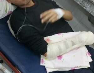 Asaltantes hieren de un balazo a estudiante para robarle celular y motocicleta | Radio Regional 660 AM