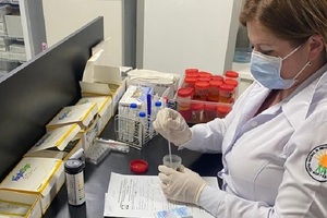 Habilitan laboratorio clínico y toxi-forense en el Centro Nacional de Adicciones | Lambaré Informativo