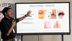 Paraguay estudia un tercer caso posible de viruela símica