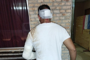 Motociclista ebrio es aprehendido tras protagonizar accidente de tránsito